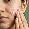 acure face wash